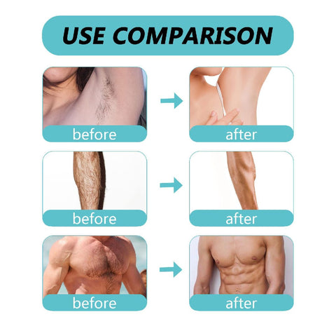 Ecrin Hair Remover Spray – Pain-Free, Fast & Smooth Skin at Home!